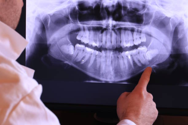Best Urgent Care for Lost Fillings or Crowns in Millville, UT
