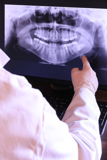 Best Emergency Dental Care for Broken or Chipped Teeth in Millville, UT