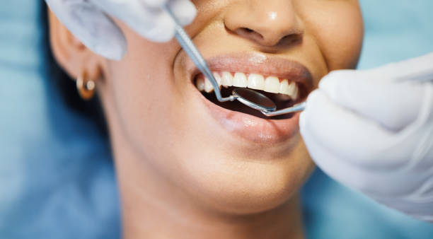 Best Emergency Root Canal Treatment in Millville, UT